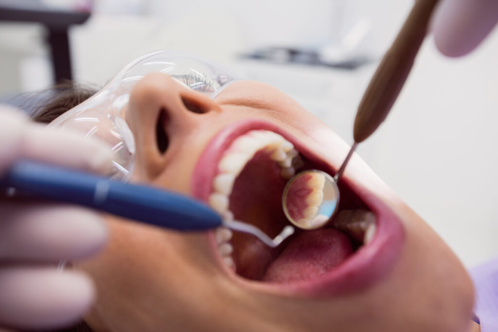 root-canal